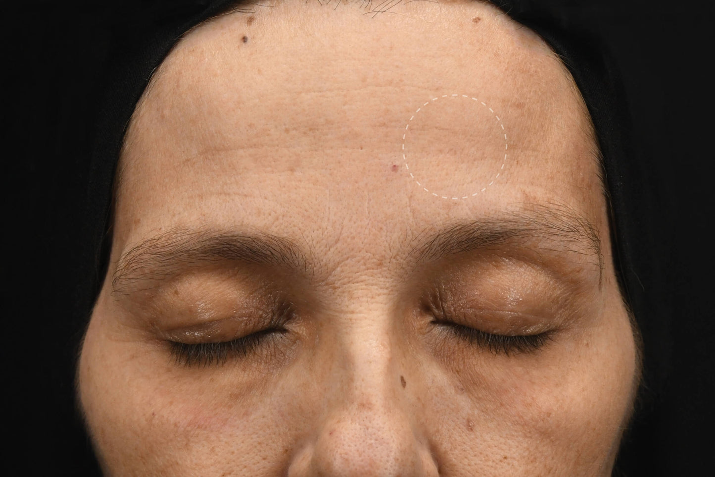 Synergie Skin Acceler-A Vitamin A Serum